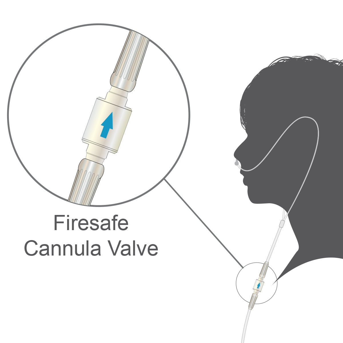 Firesafe Cannula Valve Oxygen Supply Tubing Connector (Male to Male)