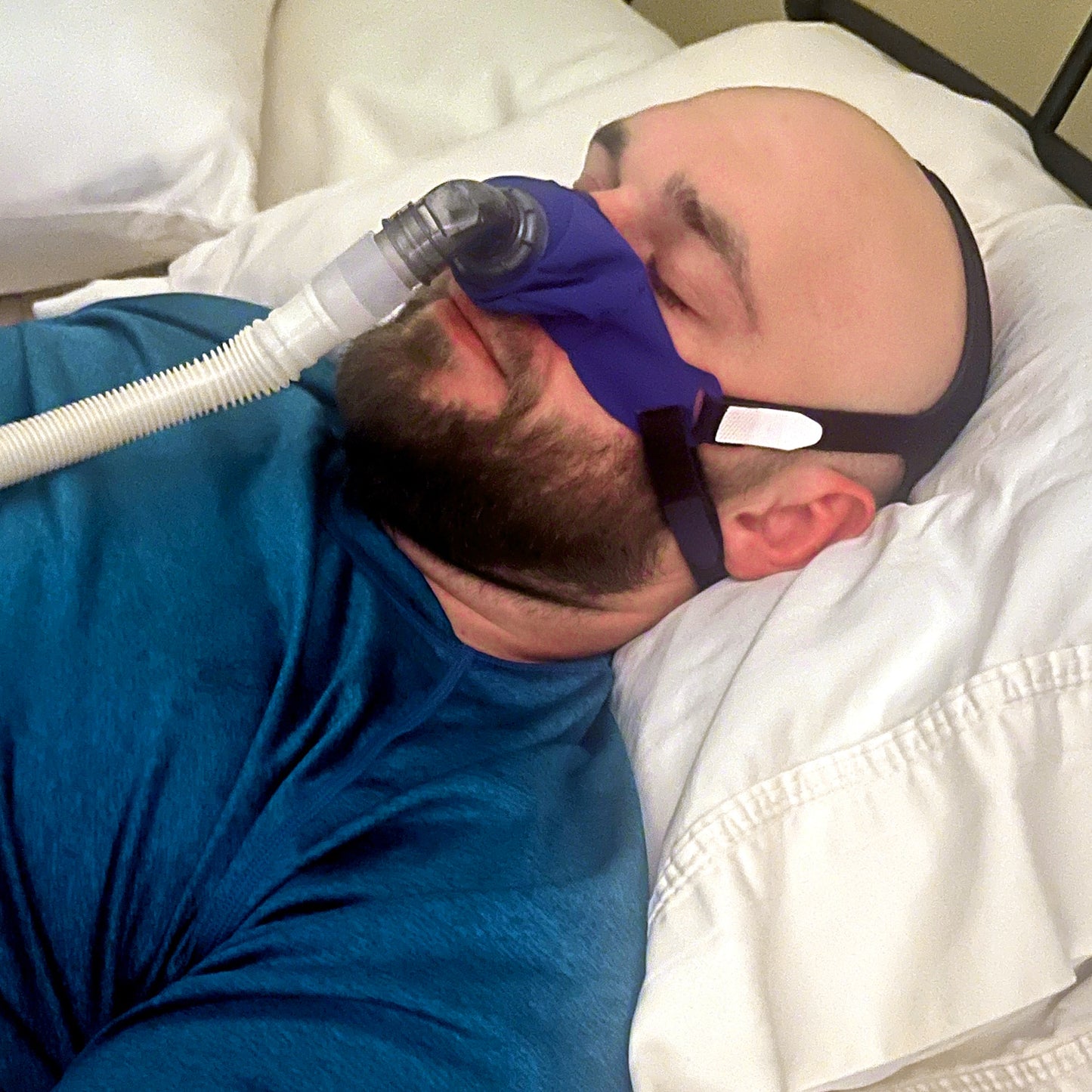 SleepWeaver 3D Soft Cloth Nasal CPAP/BiPAP Mask with Headgear